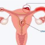 Understanding Female Fertility: Factors, Diagnosis, and Treatment