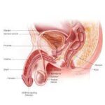 Understanding Prostate Cancer: Symptoms, Diagnosis, and Treatment Options