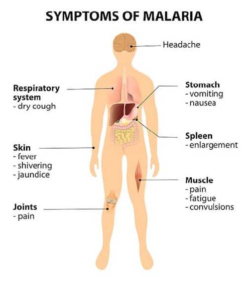 Symptoms of malaria