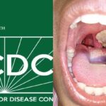NCDC-diphtheria-outbreak-in-Abuja (1)