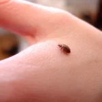 bed-bug-on-hand_2592x1944