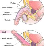 Erectile Dysfunction in Africa