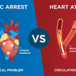 cardiac arrest v heart attack
