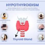 main hypo