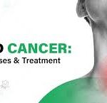 Thyroid Cancer: Symptoms, Risk Factors, and Treatment