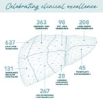 South africa liver transplant milestone celebrated by surgical team using machine perfusion technology