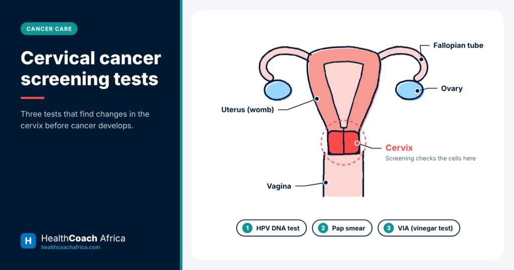 Labelled diagram of the cervix and womb showing where cervical cancer screening tests are done