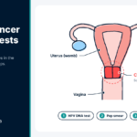 Cervical Cancer Screening Tests: A Clear Guide for Nigerian Women Labelled diagram of the cervix and womb showing where cervical cancer screening tests are done
