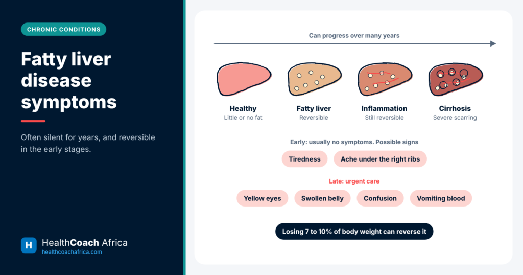 Liver diagram showing four stages from healthy liver to cirrhosis with common fatty liver disease symptoms