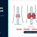 Neck diagram comparing a normal thyroid with an enlarged gland to explain goitre causes and treatment