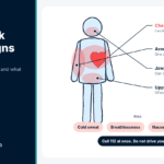 Body diagram showing where chest pain spreads and other common heart attack warning signs