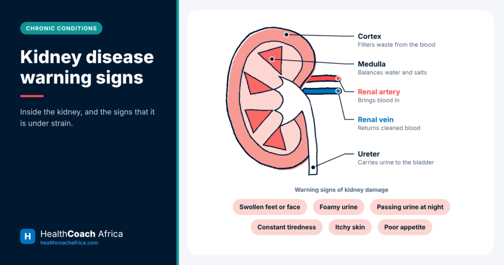 Cross-section diagram of a kidney with a list of kidney disease warning signs