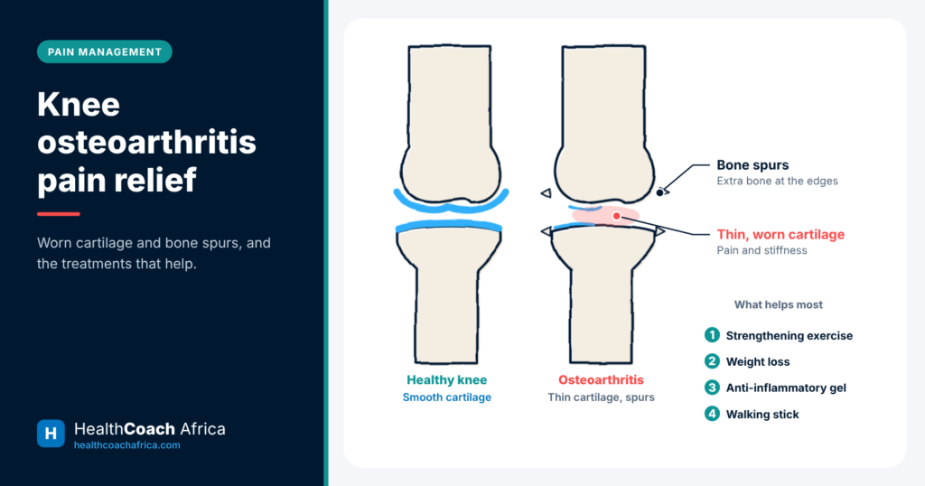 Knee joint diagram comparing healthy and worn cartilage, with options for knee osteoarthritis pain relief