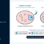 Diagram comparing a normal ovary with a polycystic ovary, explaining PCOS and getting pregnant