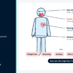 Body diagram labelling the signs of overactive thyroid, including racing heart, tremor, weight loss and eye changes