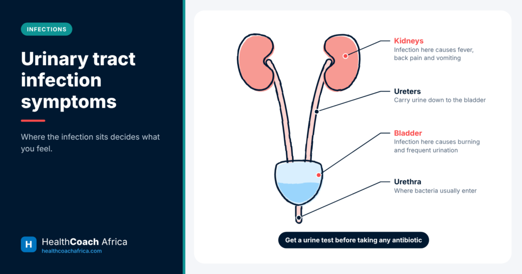 Diagram of the kidneys, ureters, bladder and urethra explaining urinary tract infection symptoms