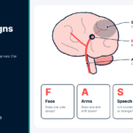 Brain diagram with a clot blocking an artery and the FAST test for the warning signs of stroke